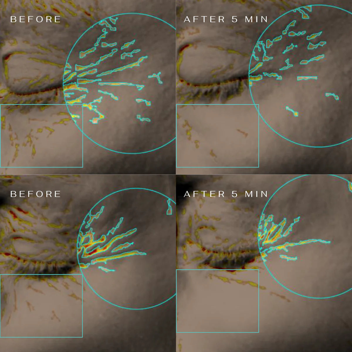 CLM paakių padeliai Miloir